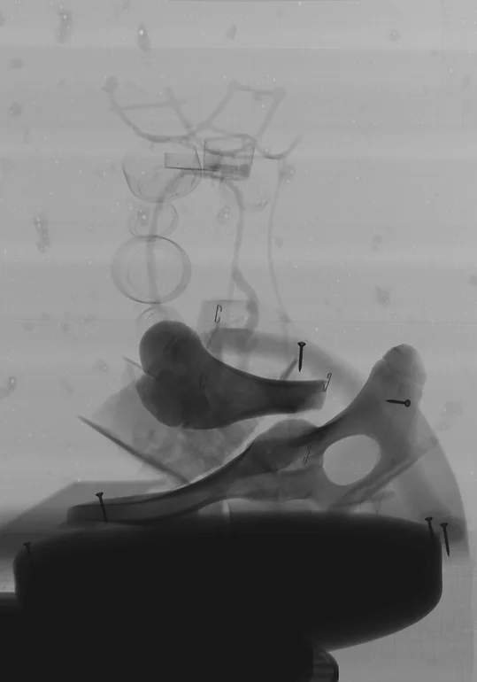 Inanimado-#4 Inanimado, Impressão fotográfica a partir de radiografia a escultura, em papel fine art, (prova única) 100x70cm, 2018-Rui-Horta-Pereira (5)